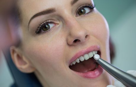 Smile Designers servicios blanqueamiento